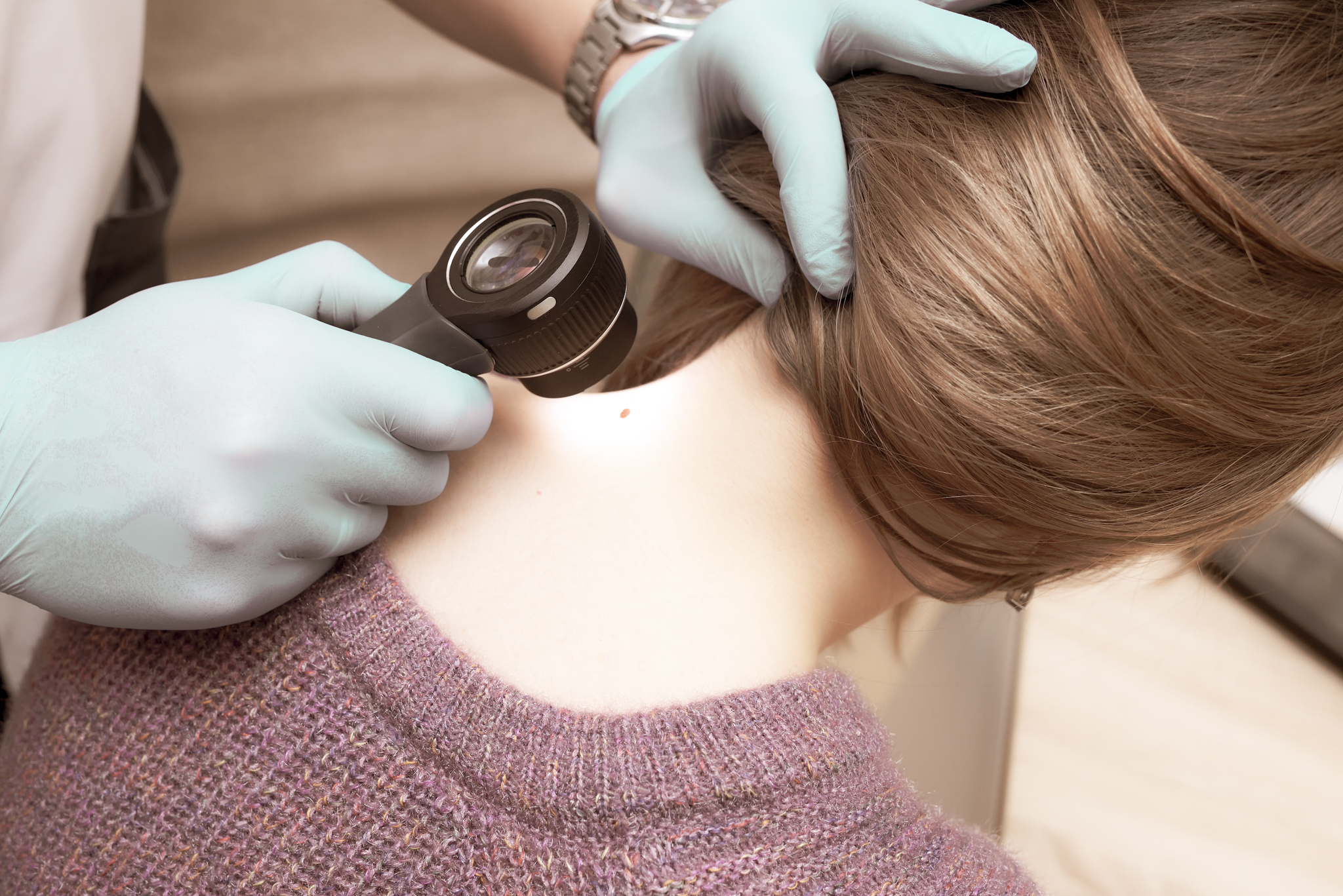 Dermatologist examining patient's skin with dermatoscope