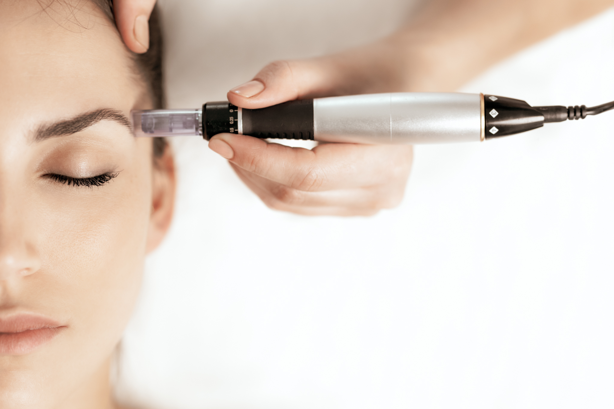 Professional microneedling treatment with SkinPen device
